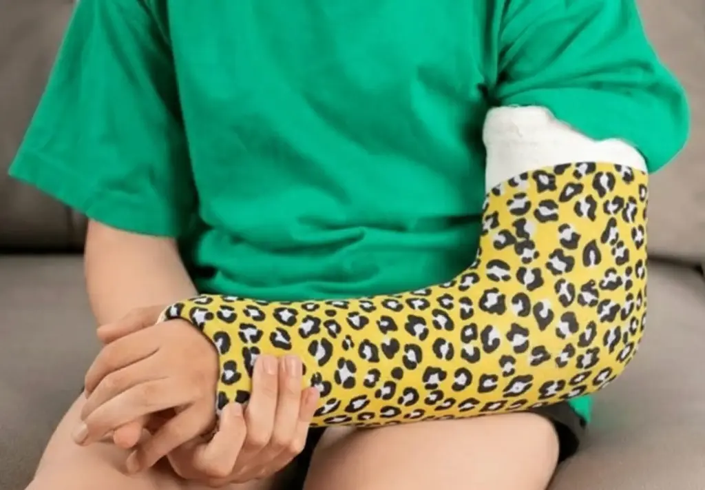 Animal fur arm cover